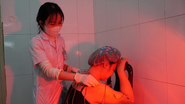 Điều trị bằng phương pháp Châm cứu